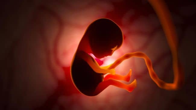 
 4 Kasus Fetus in Fetu, Kondisi Langka Bayi ‘Hamil’ Kembarannya